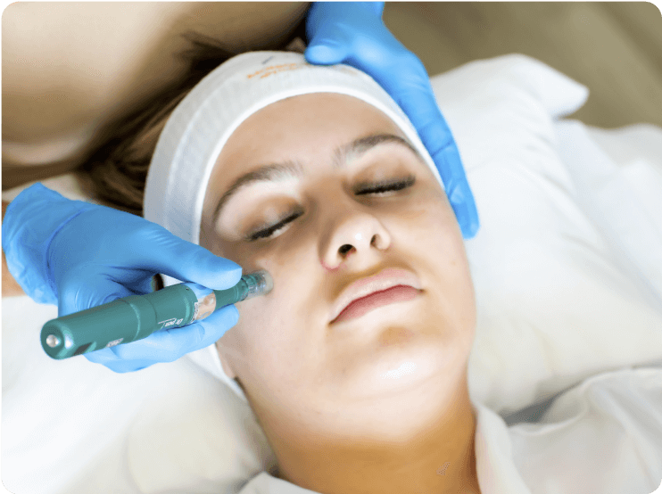 GlowRevive Microneedling