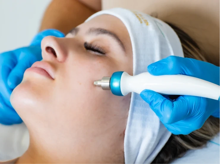 diamond peel